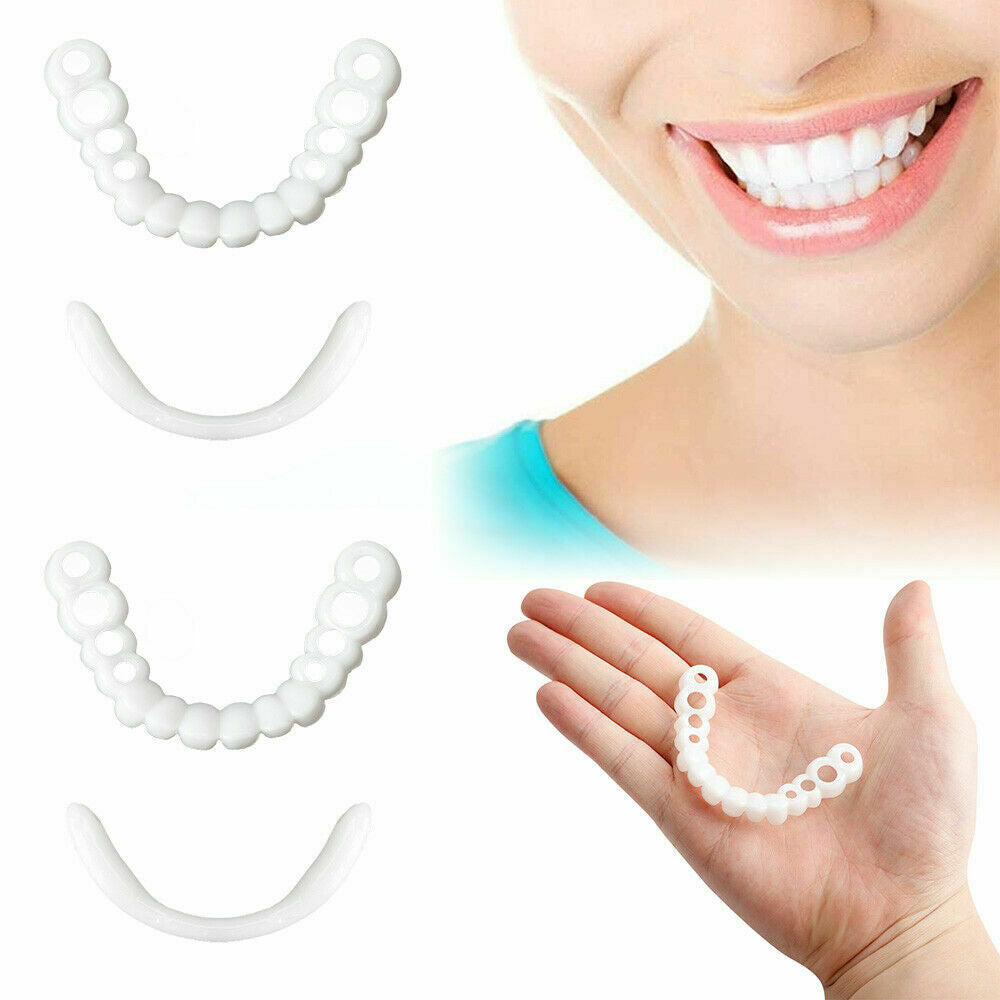 SnapOn Smile Veneers